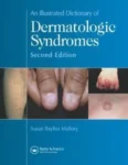 an-illustrated-dictionary-of-dermatologic-syndromes-original-imagky7jnknn9afa